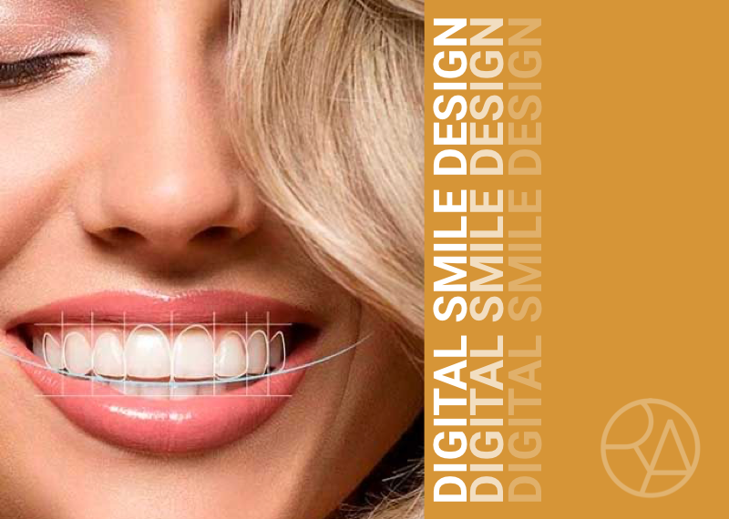 Digital Smile Design – DSD